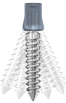 Sistema Xia II